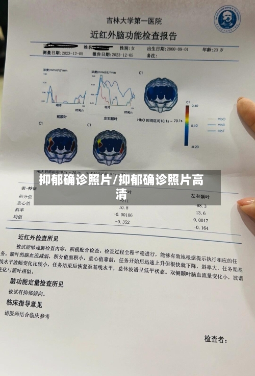 抑郁确诊照片/抑郁确诊照片高清
