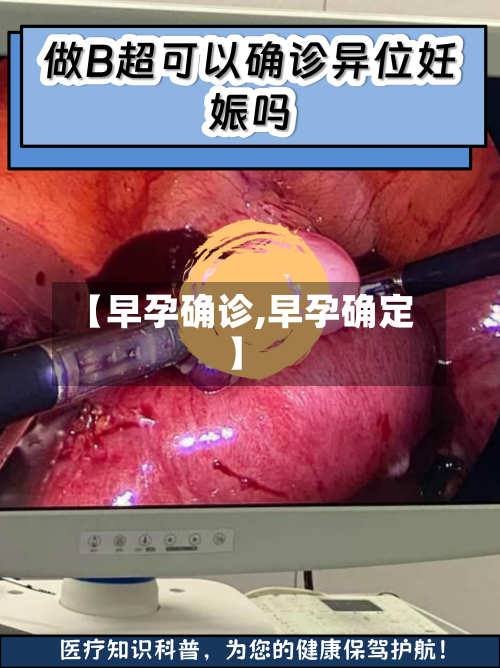 【早孕确诊,早孕确定】