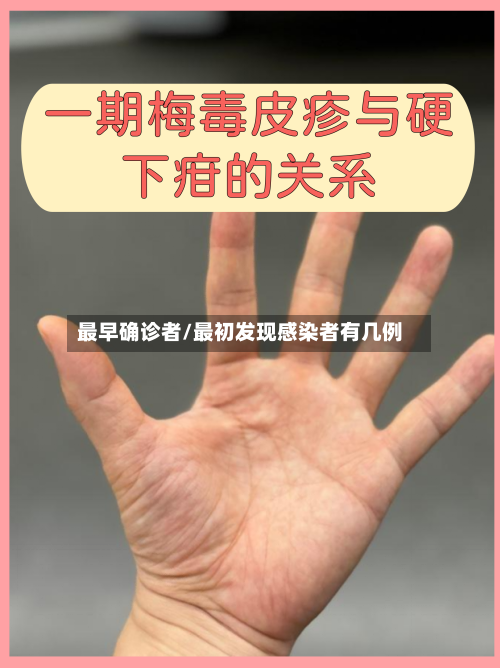 最早确诊者/最初发现感染者有几例