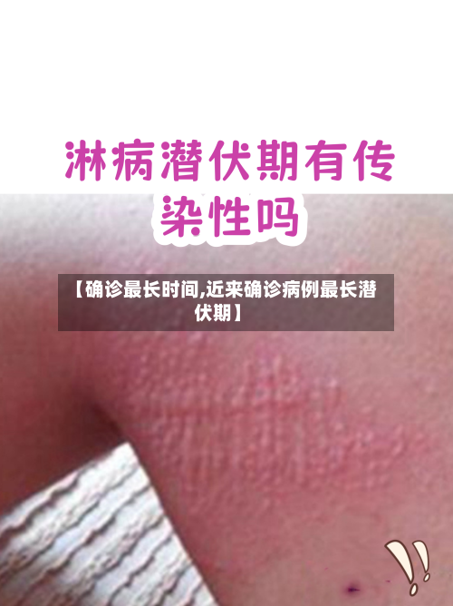 【确诊最长时间,近来确诊病例最长潜伏期】