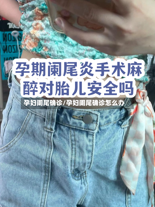 孕妇阑尾确诊/孕妇阑尾确诊怎么办