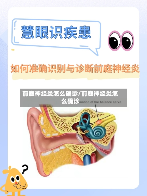 前庭神经炎怎么确诊/前庭神经炎怎么确诊