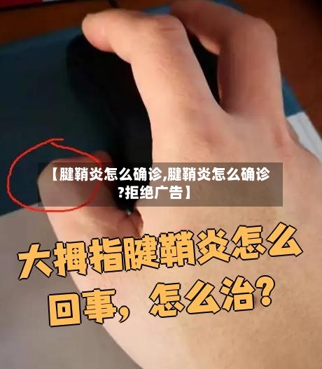 【腱鞘炎怎么确诊,腱鞘炎怎么确诊?拒绝广告】
