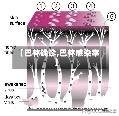 【巴林确诊,巴林感染率】